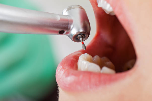Best Broken Tooth Emergency  in Tuckahoe, NY